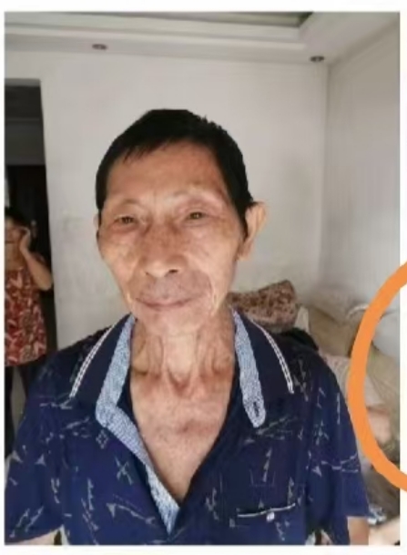 走失者照片 新余市寻人：八旬老人走失，穿黑色棉...