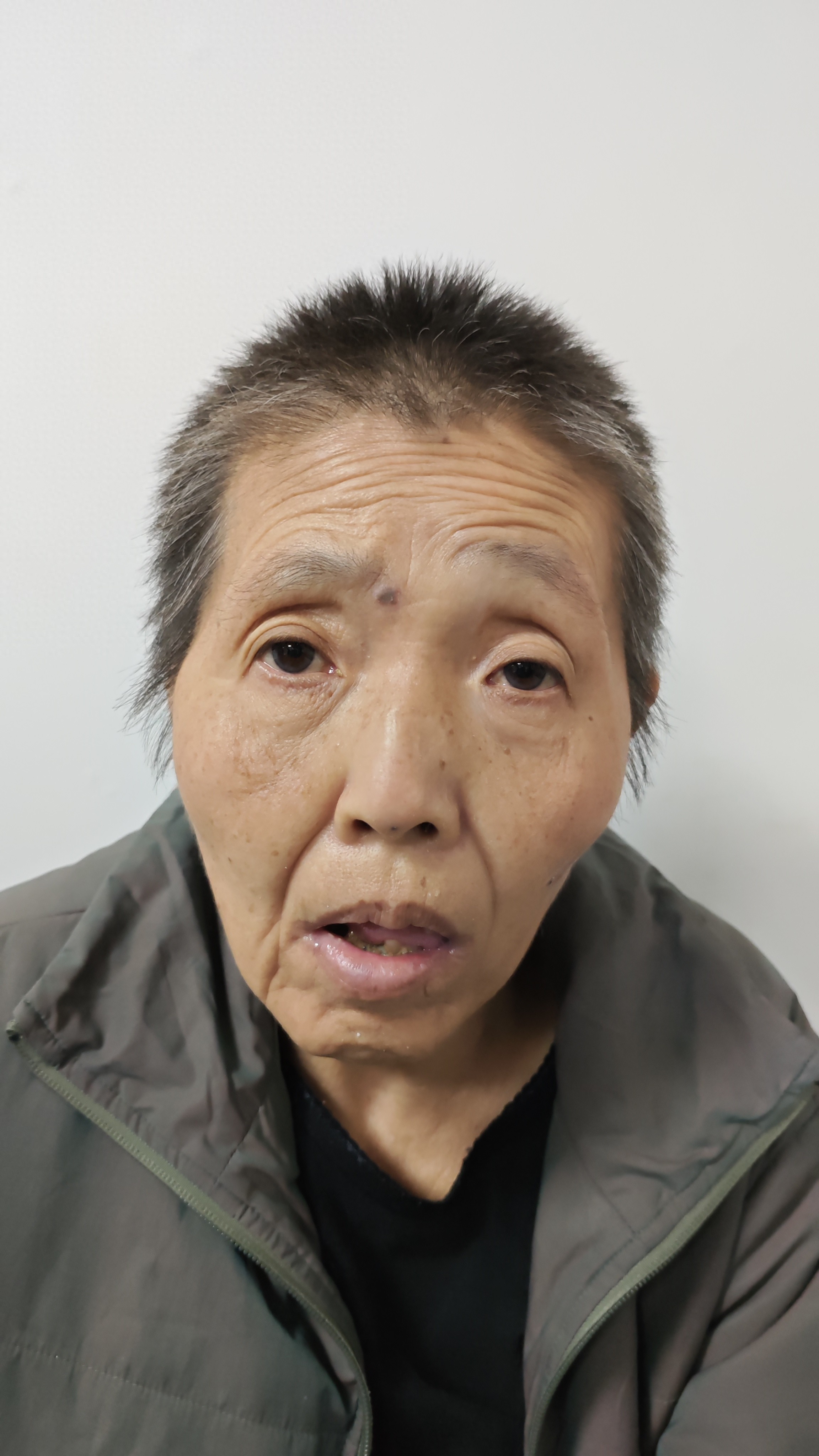 走失者照片 清远市寻亲：六旬老太被救助，高1米...