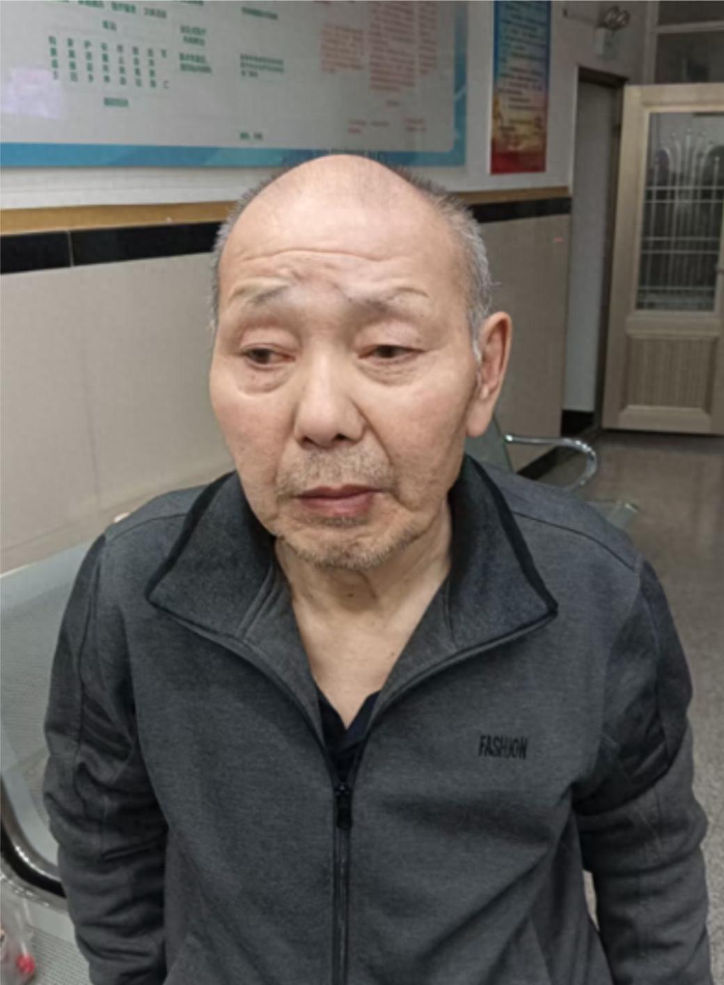走失者照片 四平市寻亲：七旬老人被救助，自述叫...