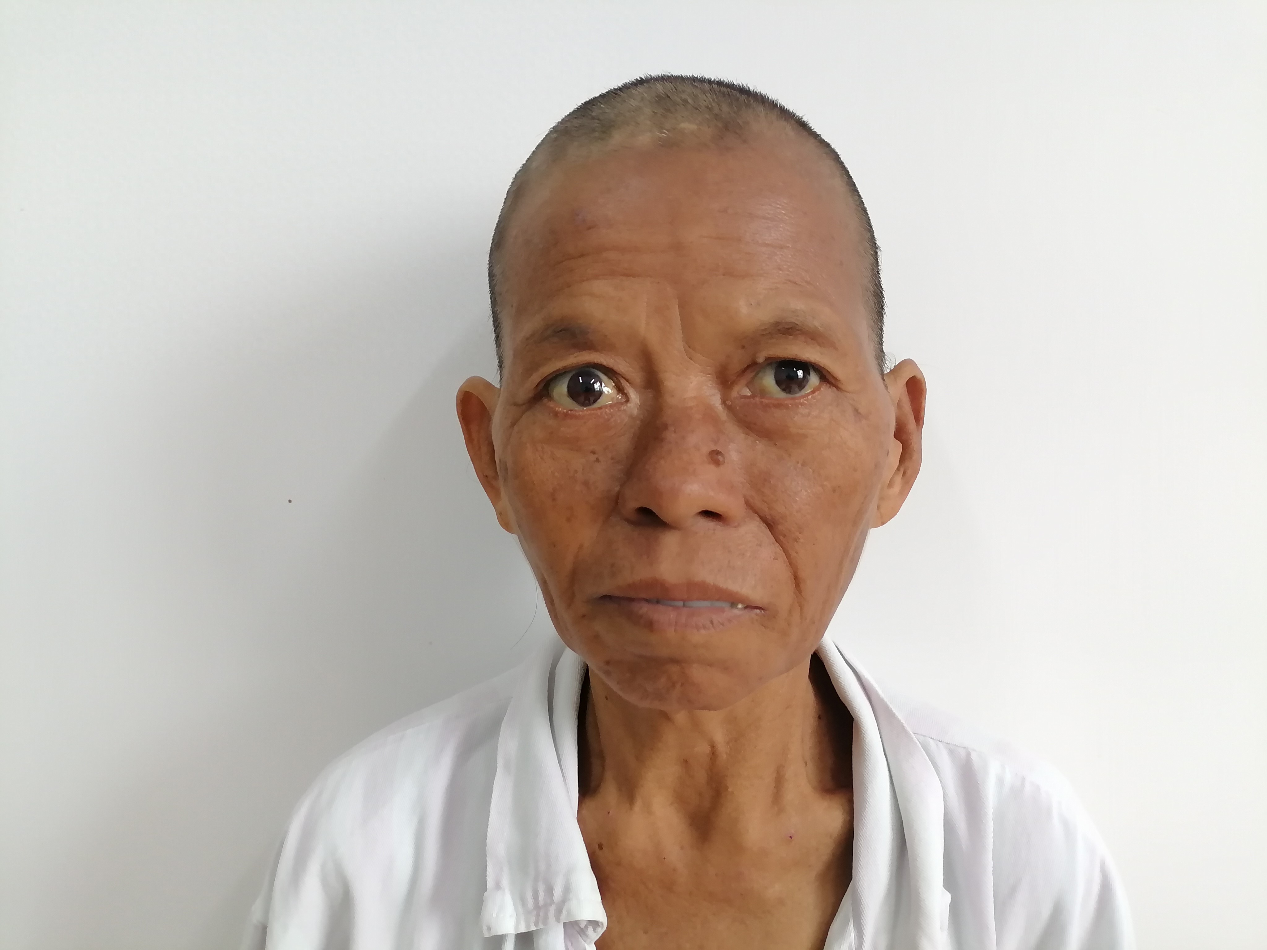 走失者照片 北海市寻亲：六旬老太被救助，穿灰色...