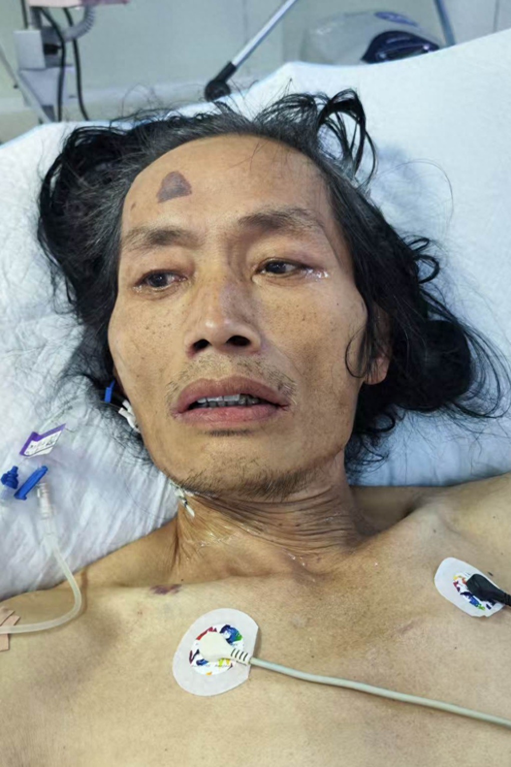走失者照片 大理州大理市寻亲：中年男子因病医治...