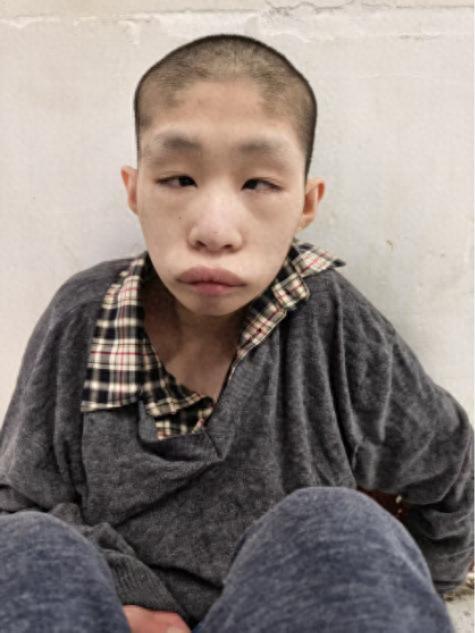 走失者照片 济宁市寻亲：青年男子被救助，疑患智...