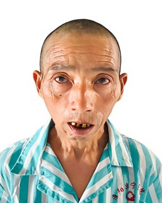 走失者照片 周口市寻亲：五旬男子被救助，系聋哑...