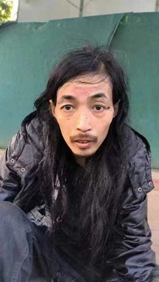 走失者照片 郑州市寻亲：中年男子被救助，行动困...