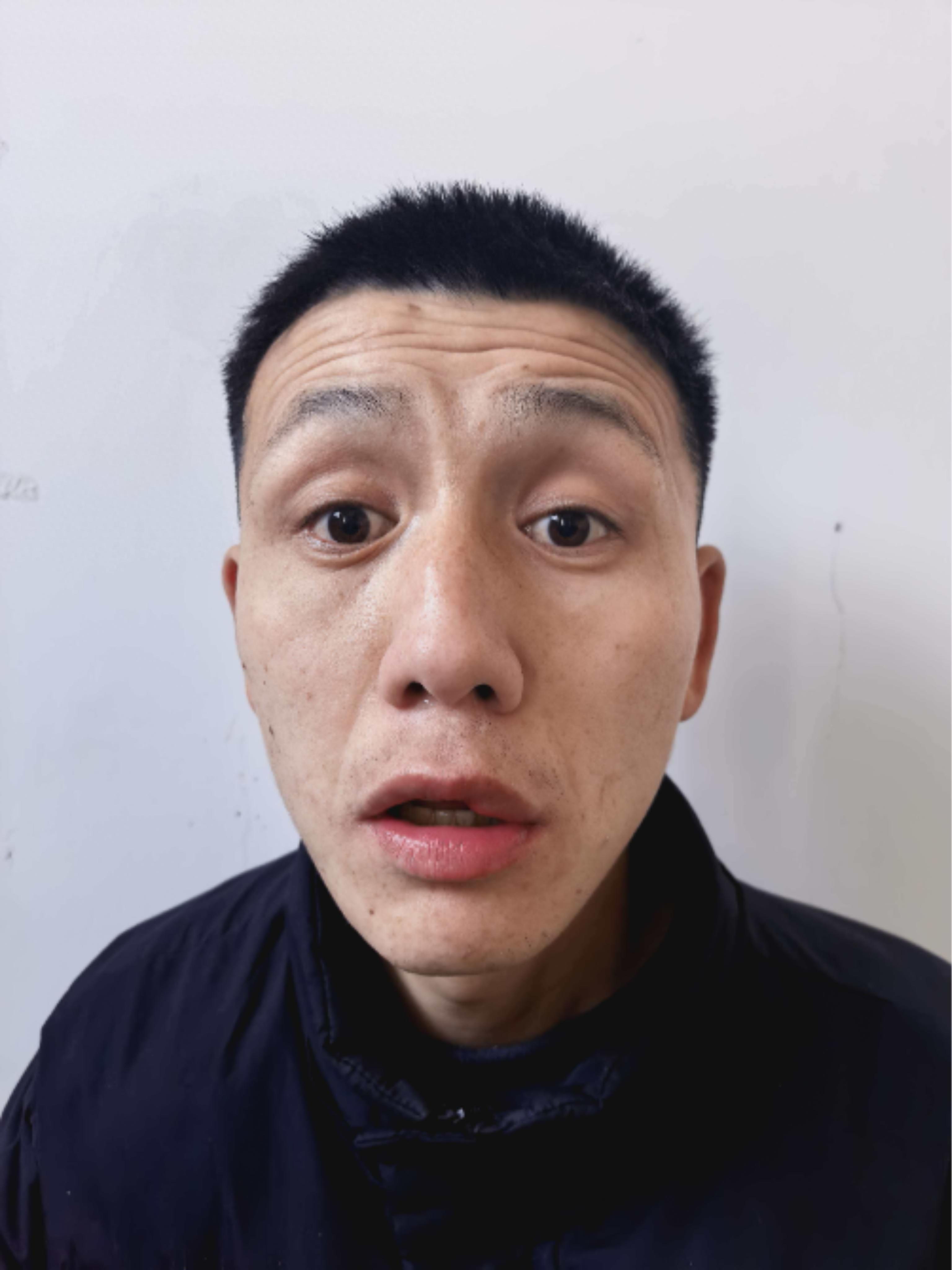 走失者照片 北京市寻亲：青年男子被救助，疑患智...