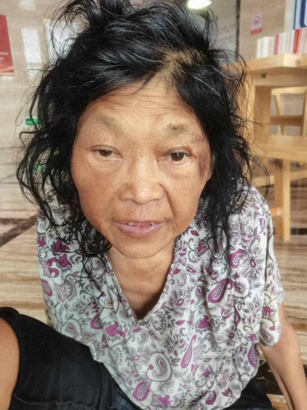 走失者照片 抚州市寻亲：六旬老太被救助，穿花短...