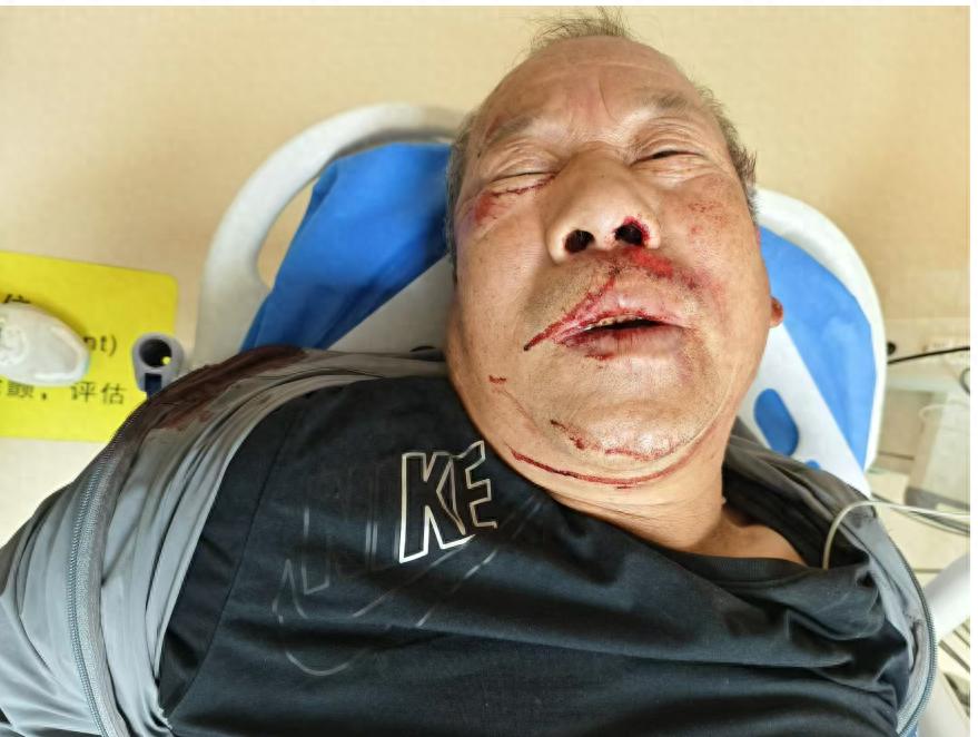 走失者照片 洛阳市寻亲：六旬老人被救助，自述叫...