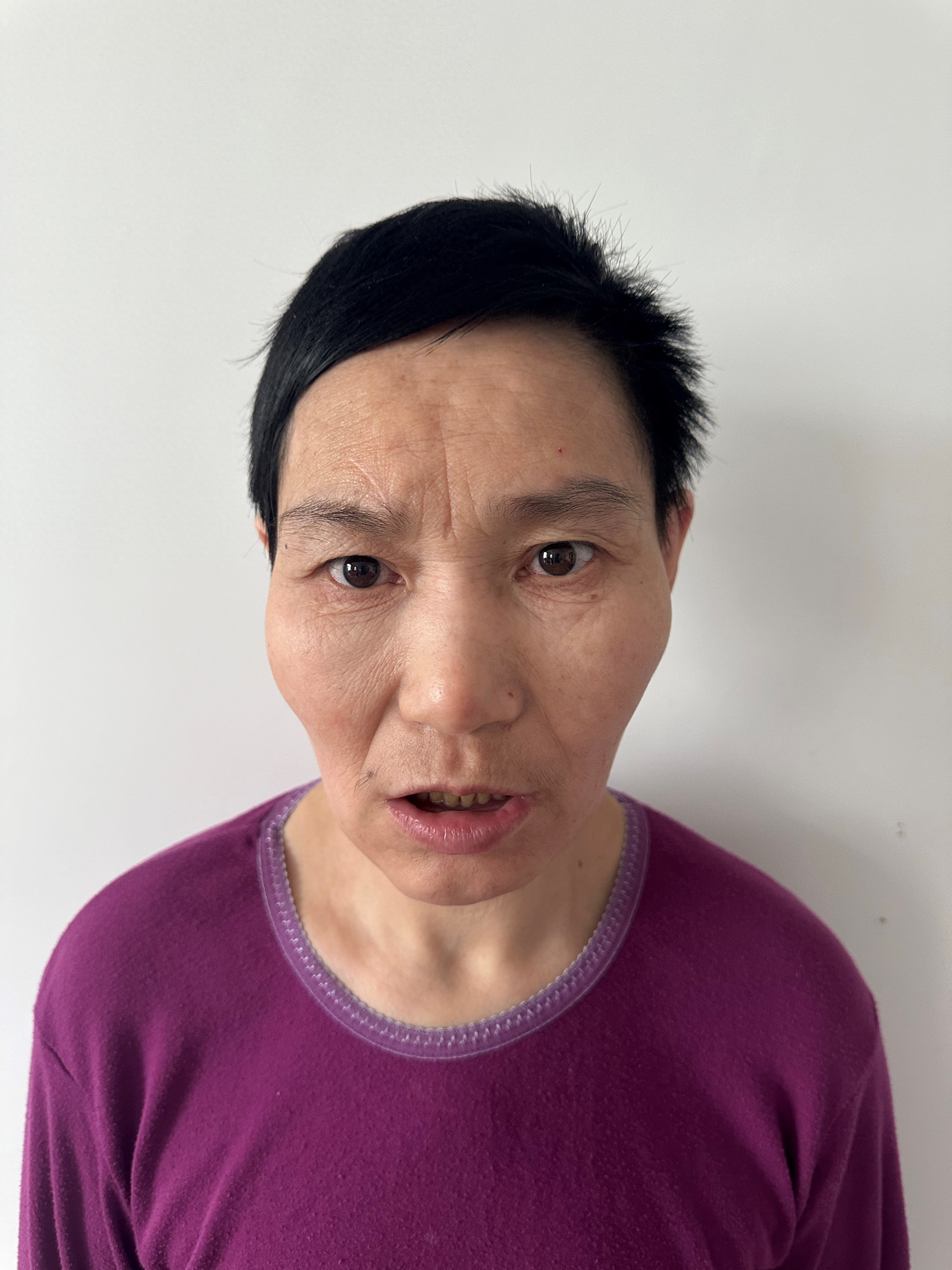 走失者照片 北京市寻亲：中年女子被救助，右臂畸...