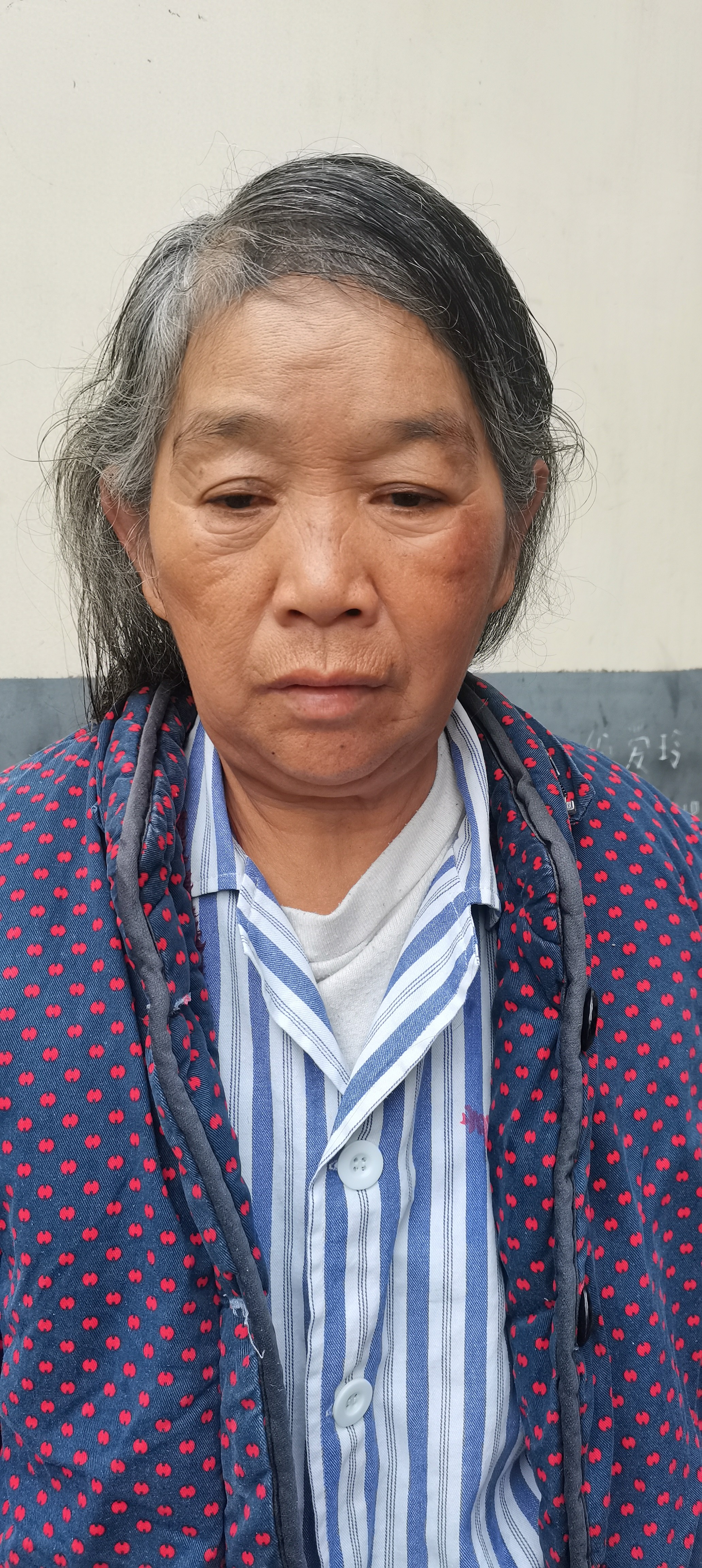 走失者照片 桂林市荔浦市寻亲：五旬女子被救助，...