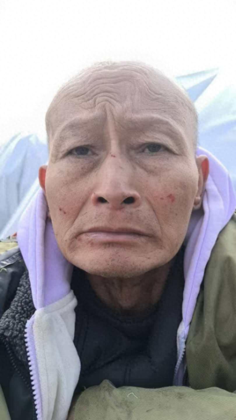 走失者照片 永州市寻亲：五旬男子被救助，疑似精...