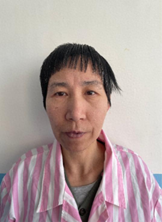 走失者照片 北京市寻亲：五旬女子被救助，疑似名...