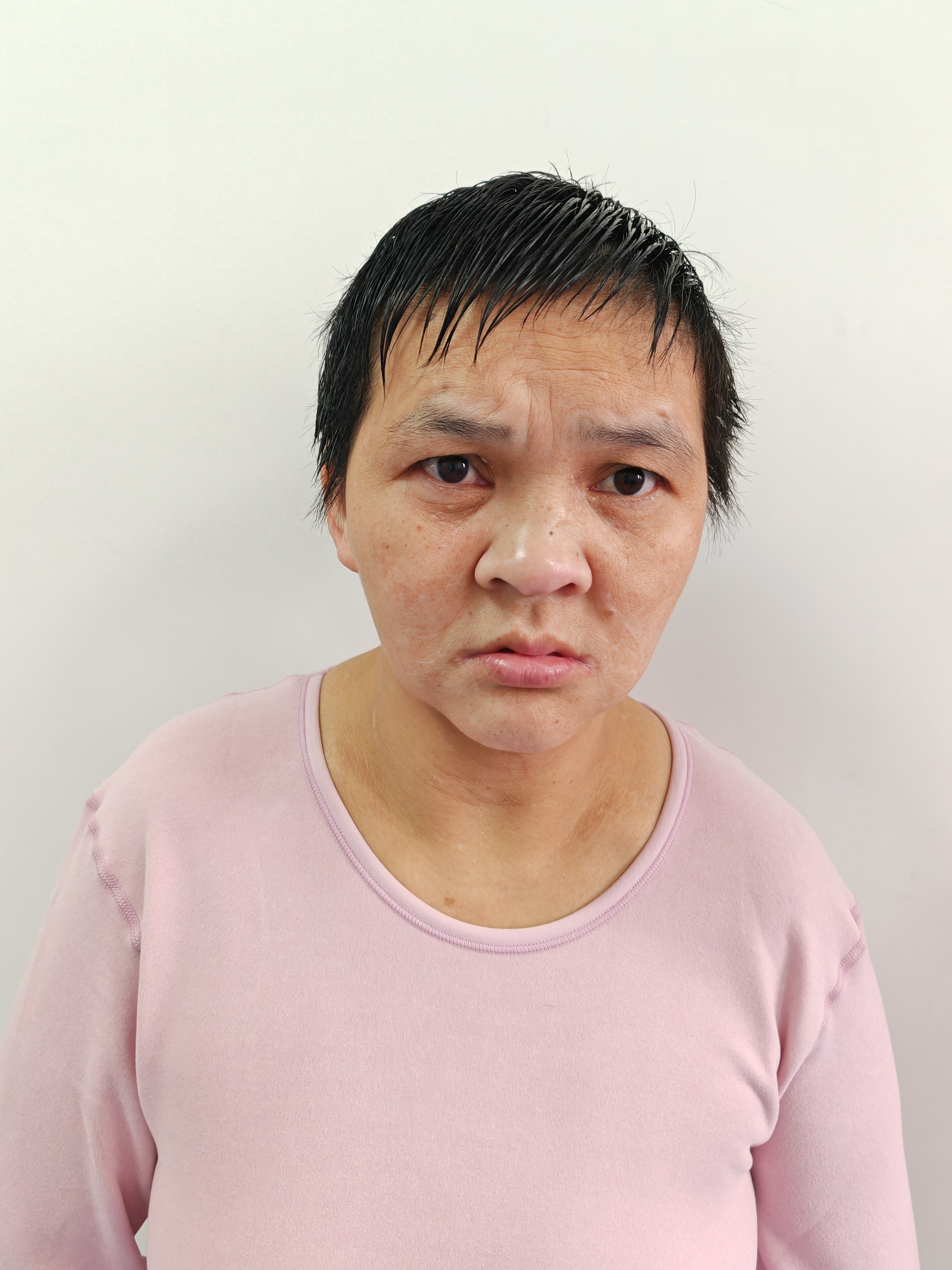 走失者照片 北京市寻亲：青年女子被救助，右小腿...