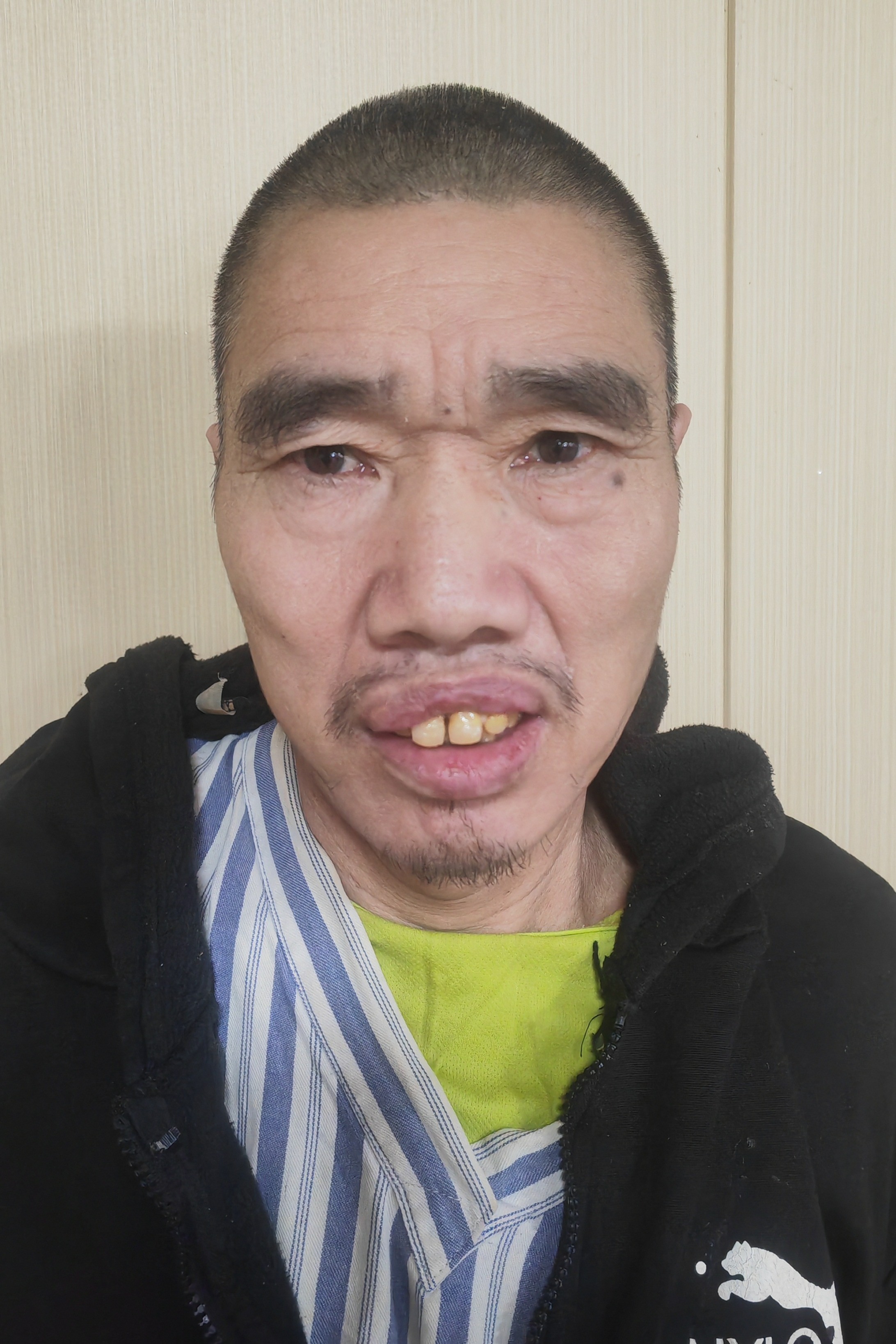 走失者照片 开封市寻亲：五旬男子被救助，穿黑色...