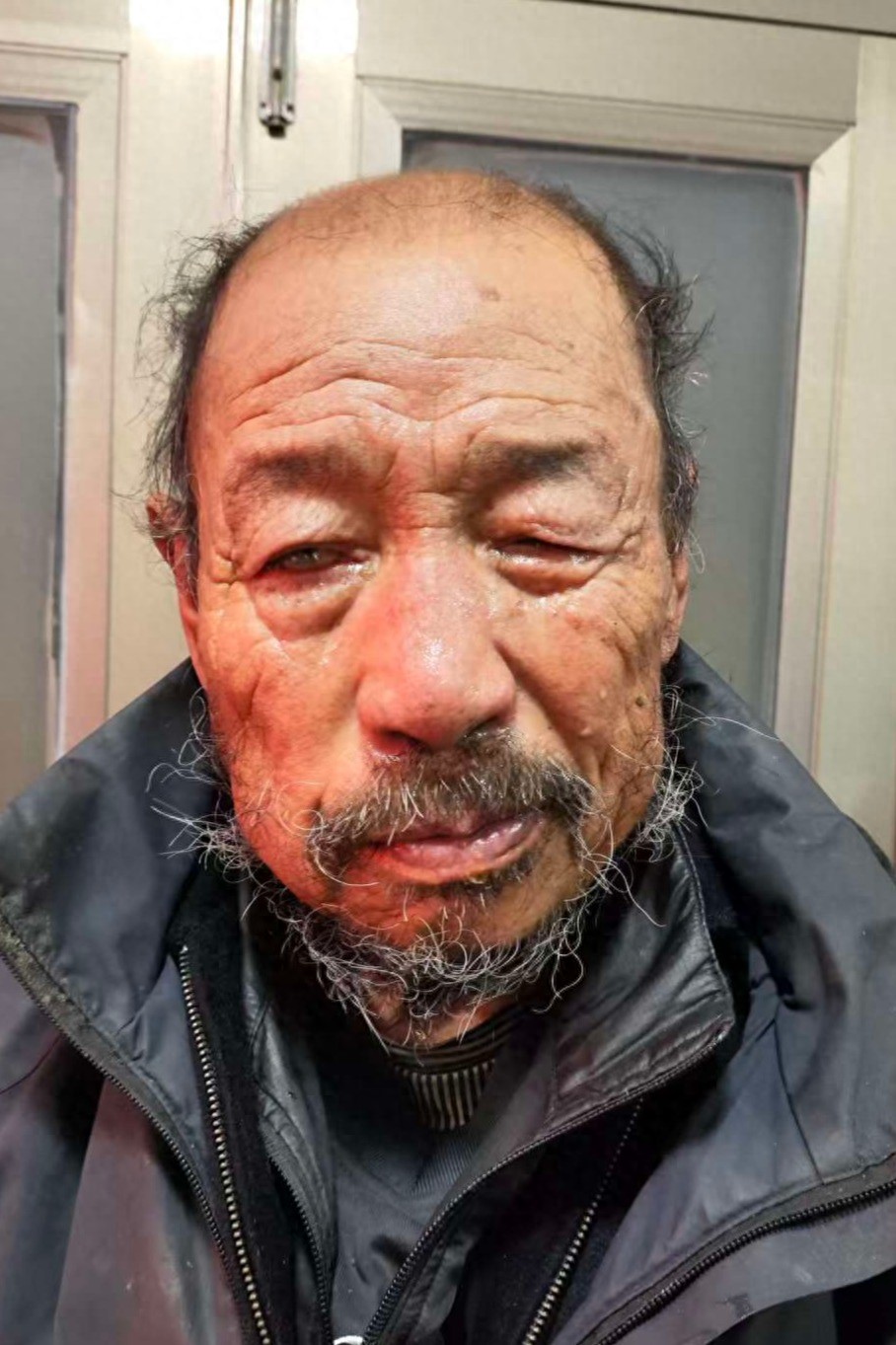 走失者照片 鞍山市寻亲：七旬老人被救助，穿黑色...