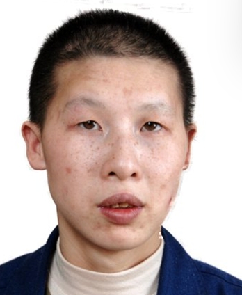 走失者照片 济南市寻亲：青年女子被救助，高1米...
