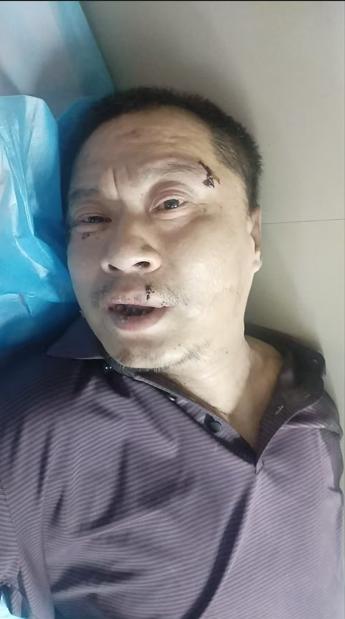 走失者照片 哈尔滨市寻亲：五旬男子被救助，穿紫...