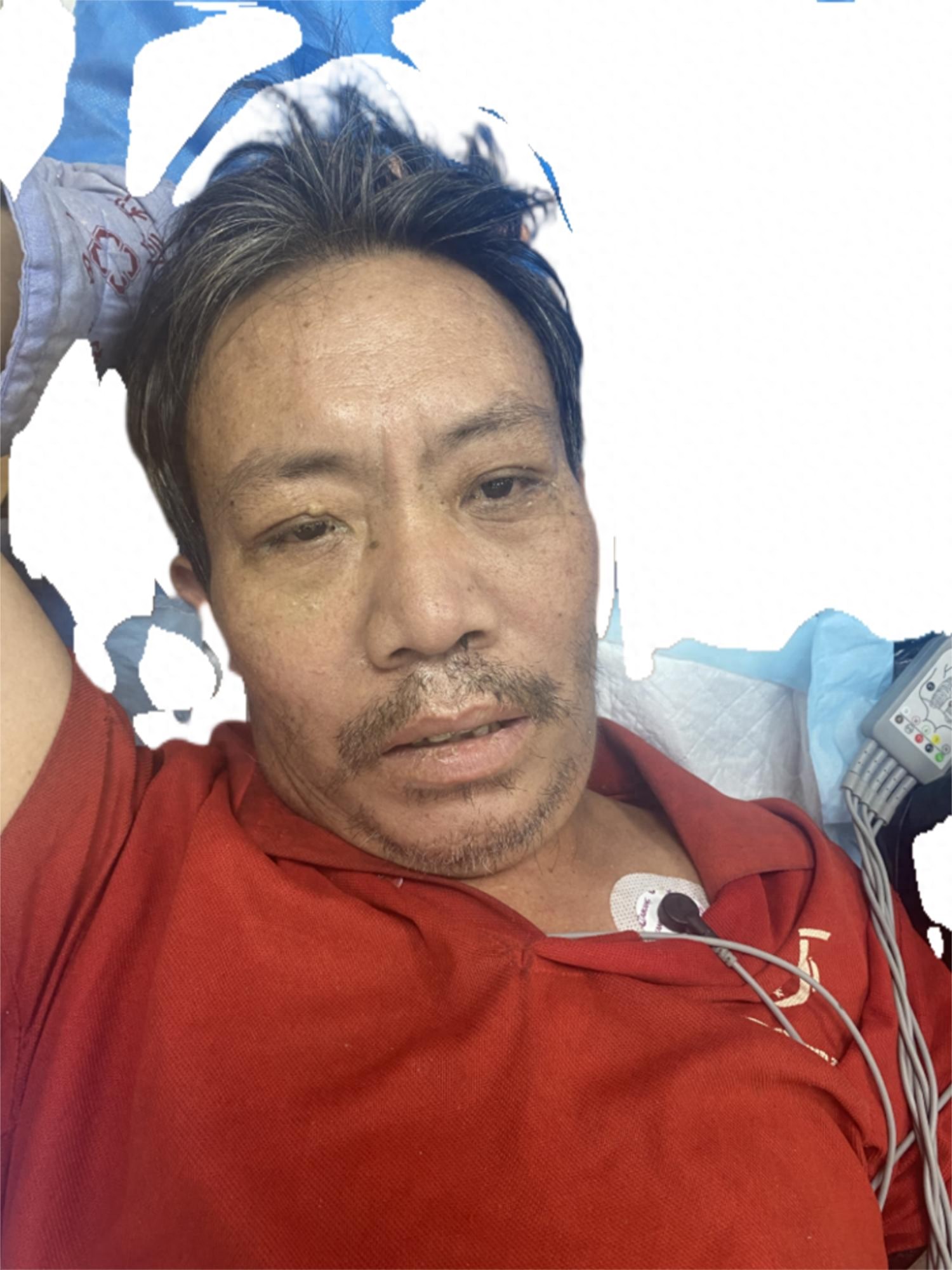 走失者照片 佛山市寻亲：五旬男子被救助，高1米...
