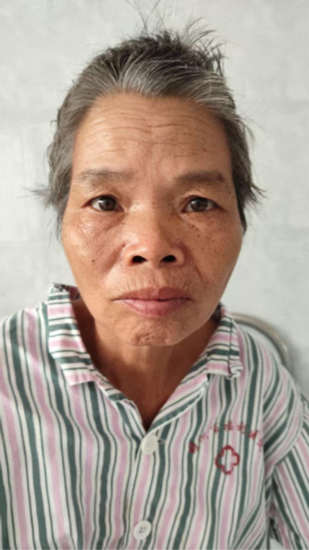 走失者照片 梧州市寻亲：六旬老太被救助，疑患精...