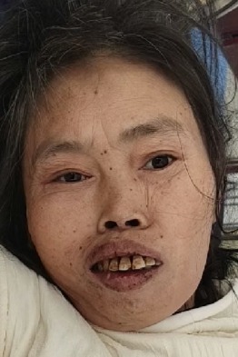 走失者照片 襄阳市寻亲：五旬女子被救助，穿灰色...