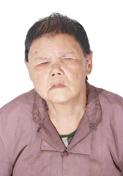 走失者照片 平顶山市寻亲：七旬老太被救助，视力...
