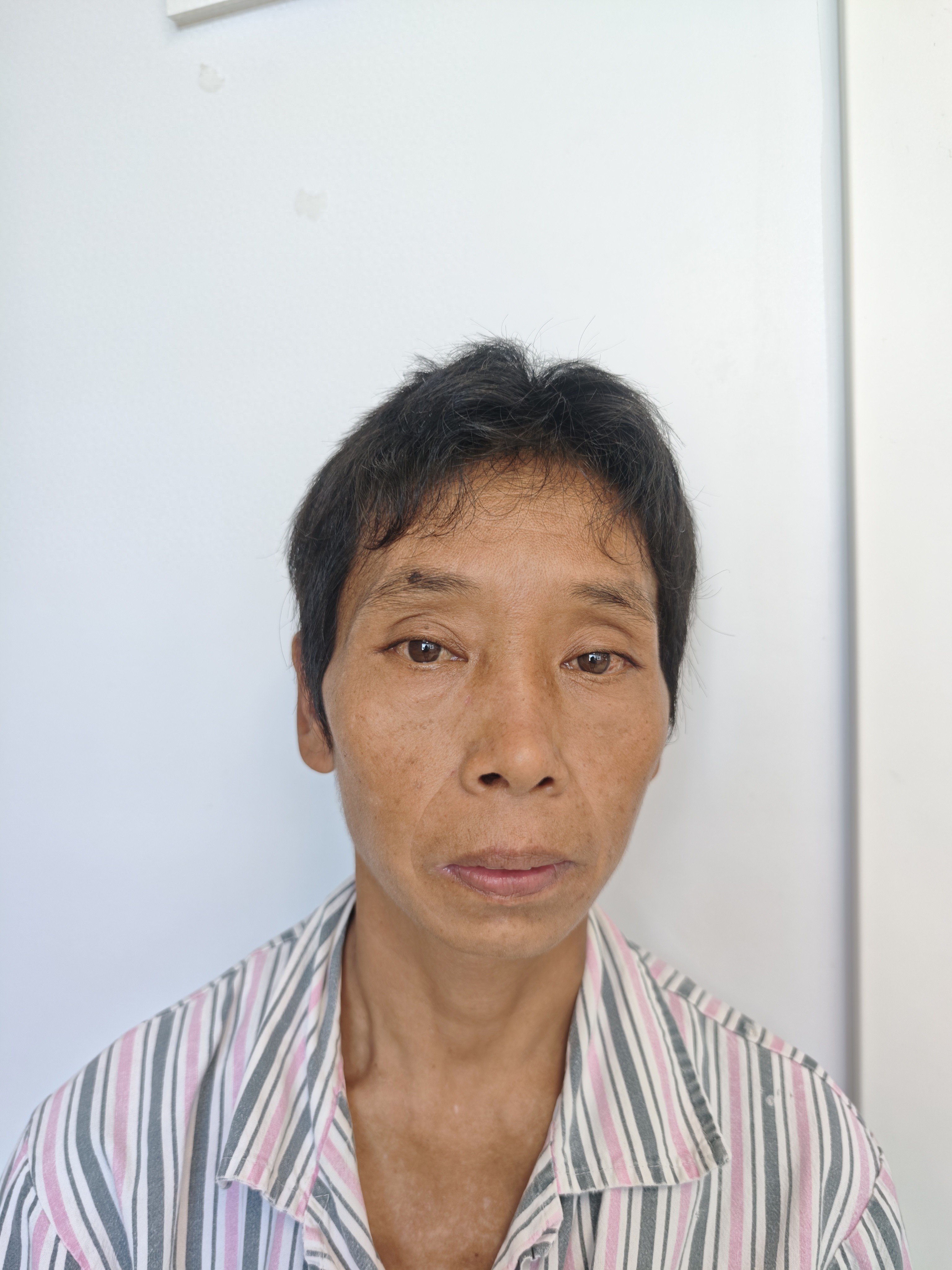 走失者照片 南京市寻亲：五旬女子被救助，疑患精...