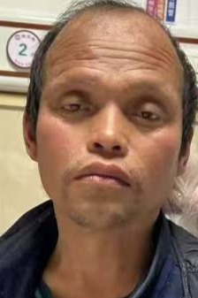 走失者照片 重庆市寻亲：青年男子被救助，背黑色...