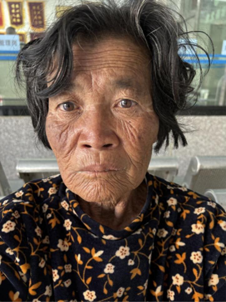 走失者照片 阳江市寻亲：五旬女子被救助，自述叫...