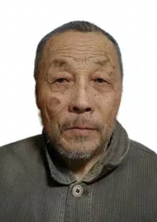 走失者照片 泰安市寻人：八旬老人走失，患小脑萎...