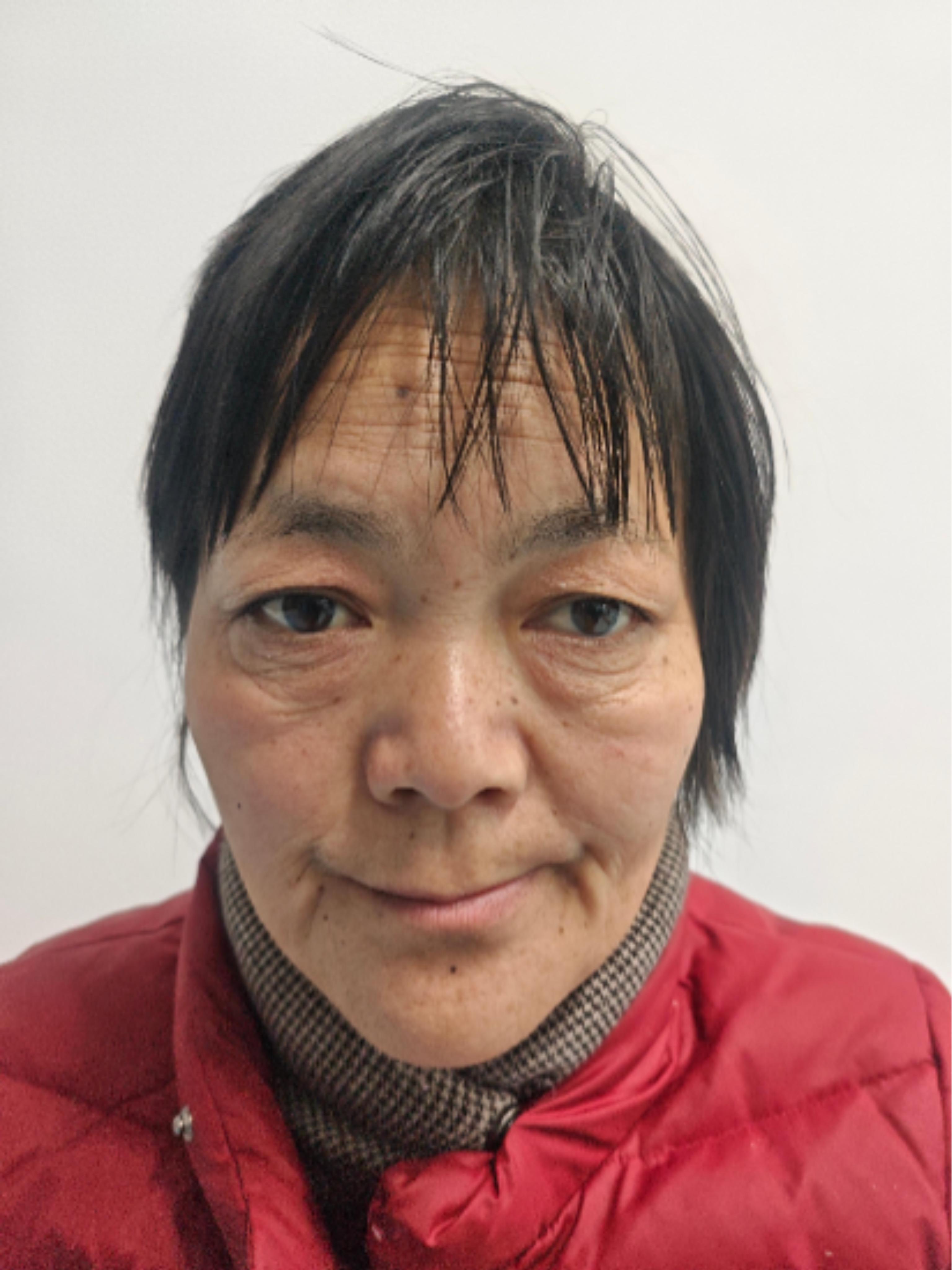 走失者照片 马鞍山市寻亲：五旬女子被救助，自述...