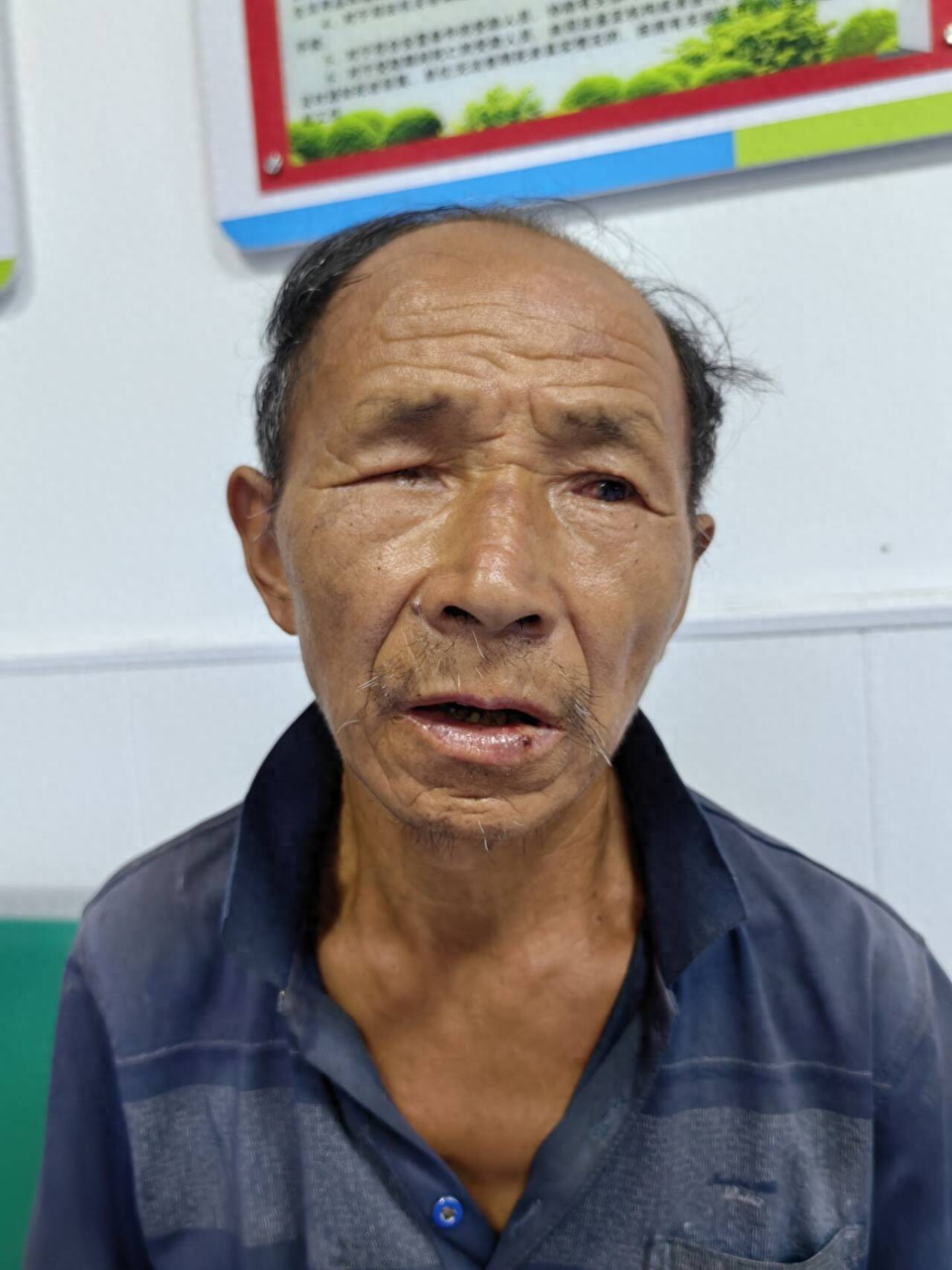 走失者照片 襄阳市寻亲：六旬老人被救助，穿蓝色...