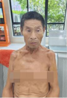 走失者照片 湖州市寻亲：六旬老人被救助，疑似智...