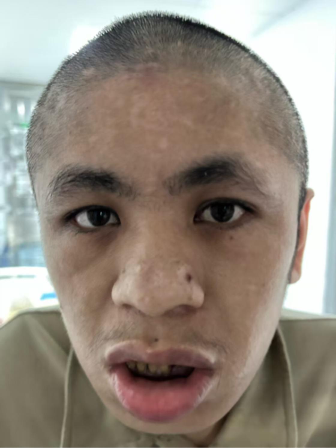 走失者照片 福州市寻亲：青年男子被救助，高1米...