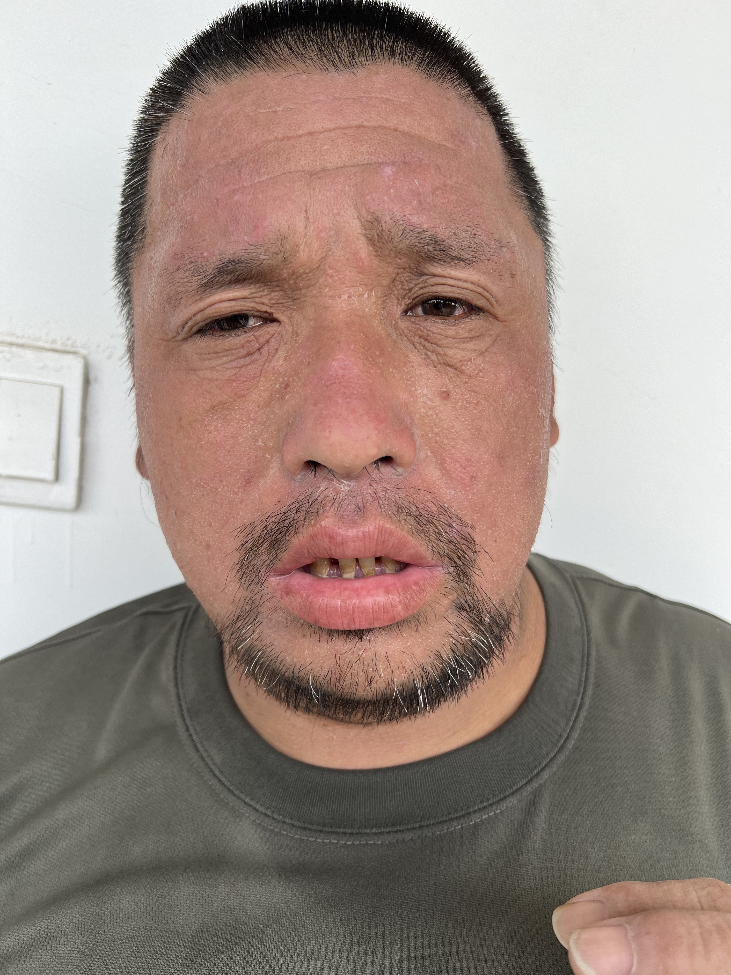 走失者照片 阜阳市界首市寻亲：青年男子被救助，...