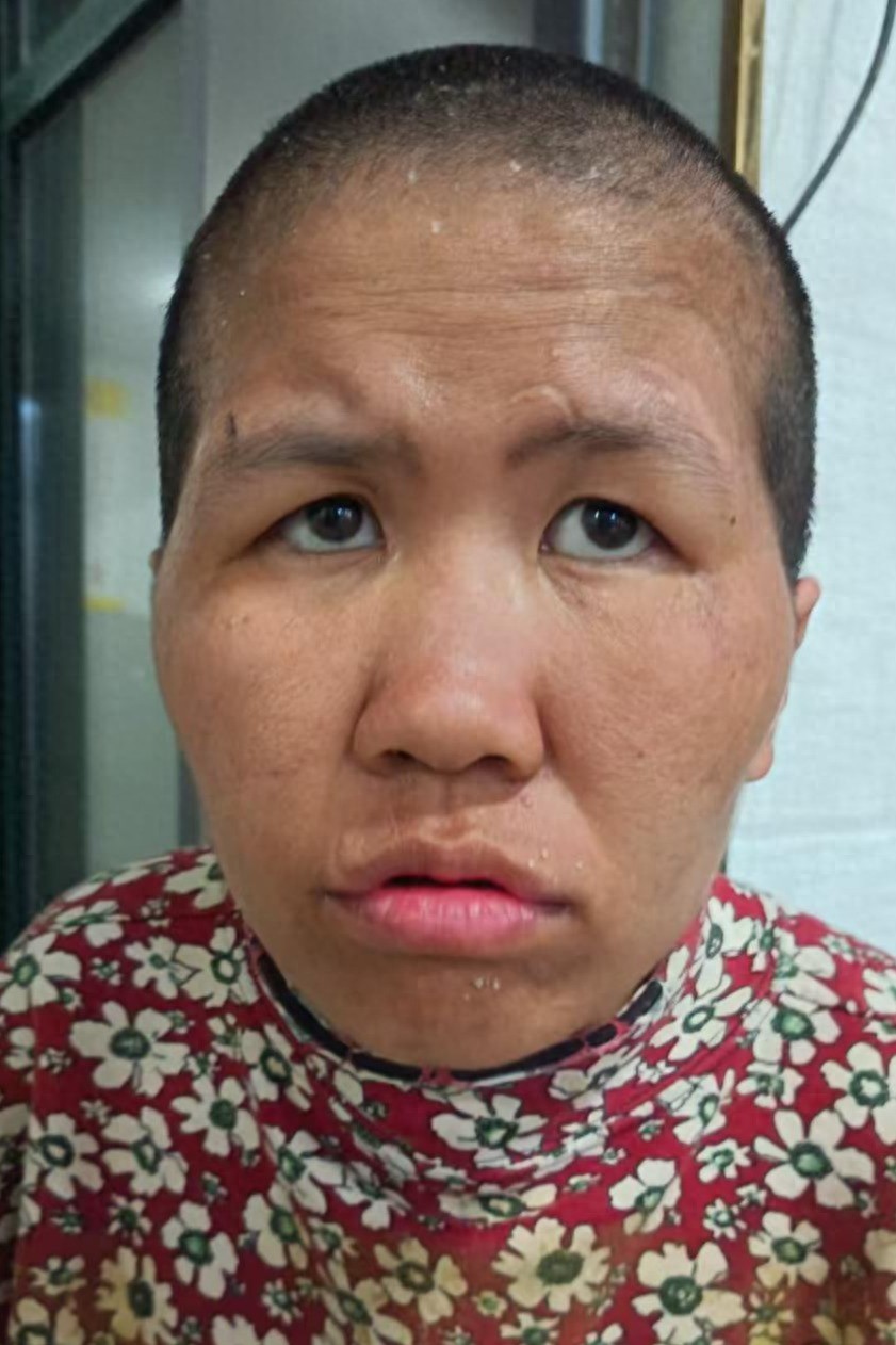走失者照片 亳州市寻亲：青年女子被救助，穿花上...