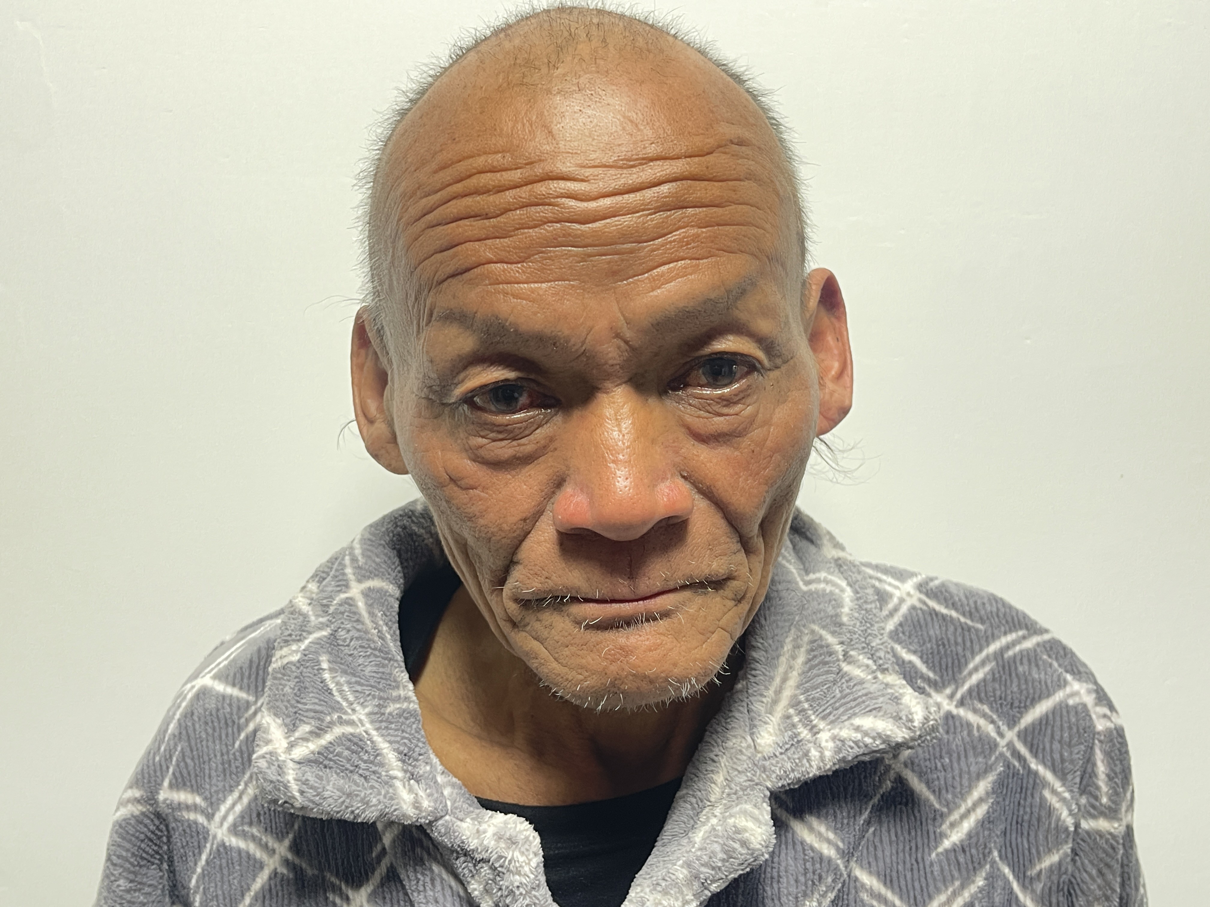 走失者照片 开封市寻亲：六旬老人被救助，穿军大...
