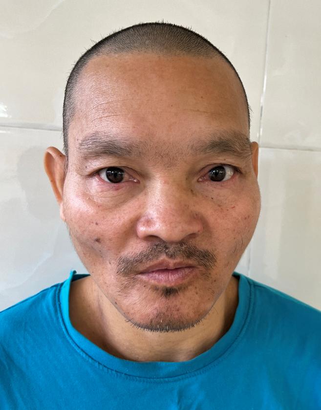 走失者照片 汕头市寻亲：中年男子被救助，疑似是...
