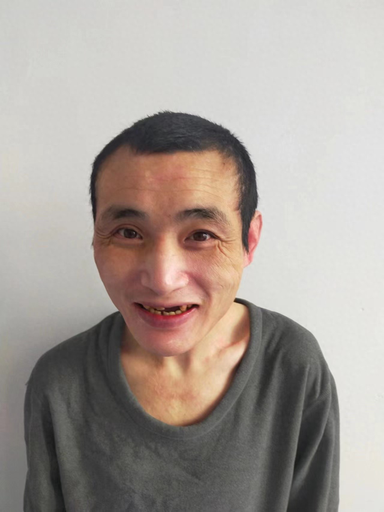 走失者照片 北京市寻亲：青年男子被救助，患癫痫...