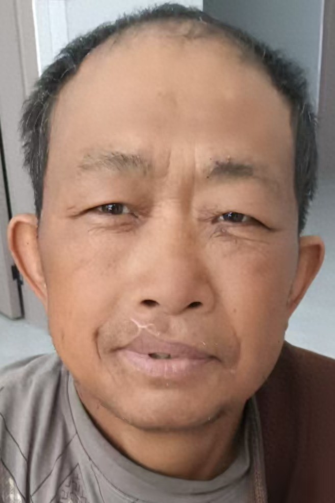 走失者照片 楚雄州禄丰市寻亲：五旬男子被救助，...