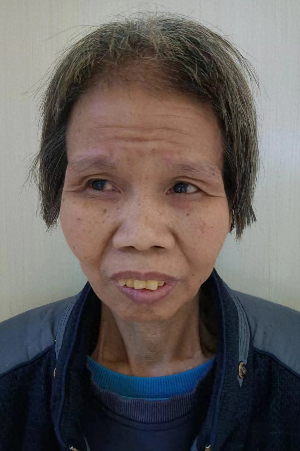 走失者照片 钦州市寻亲：六旬老太被救助，高1米...