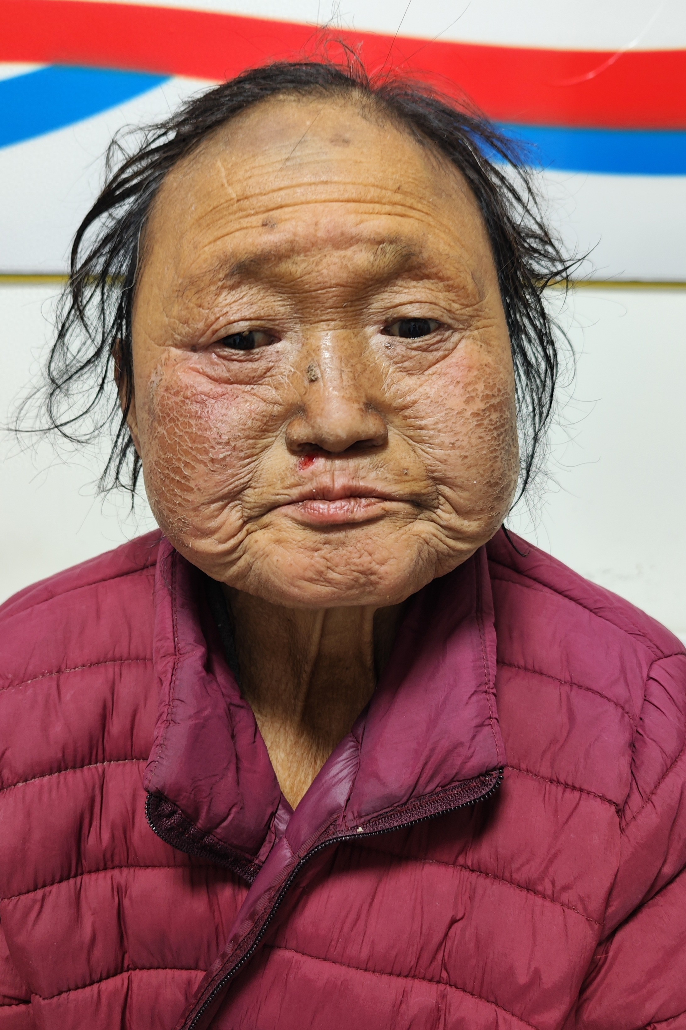 走失者照片 东营市寻亲：六旬老太被救助，自述叫...