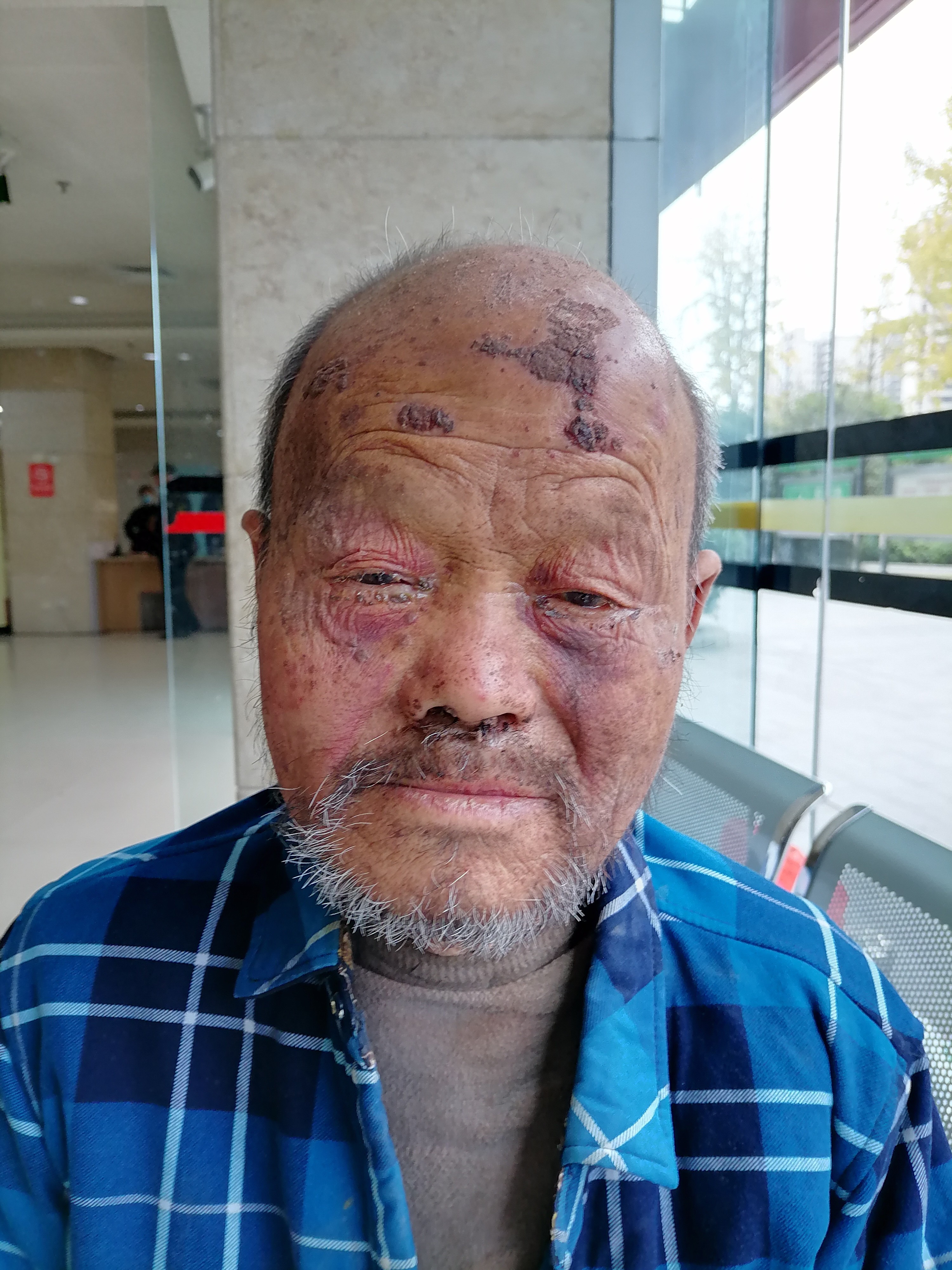 走失者照片 南充市寻亲：七旬老人被救助，穿黑色...