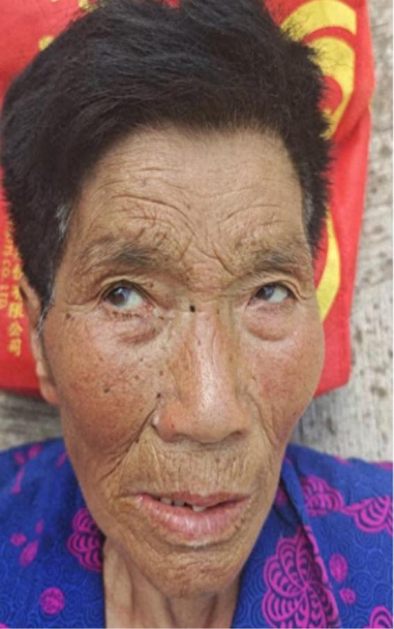 走失者照片 遂宁市射洪市寻亲：七旬老太被救助，...