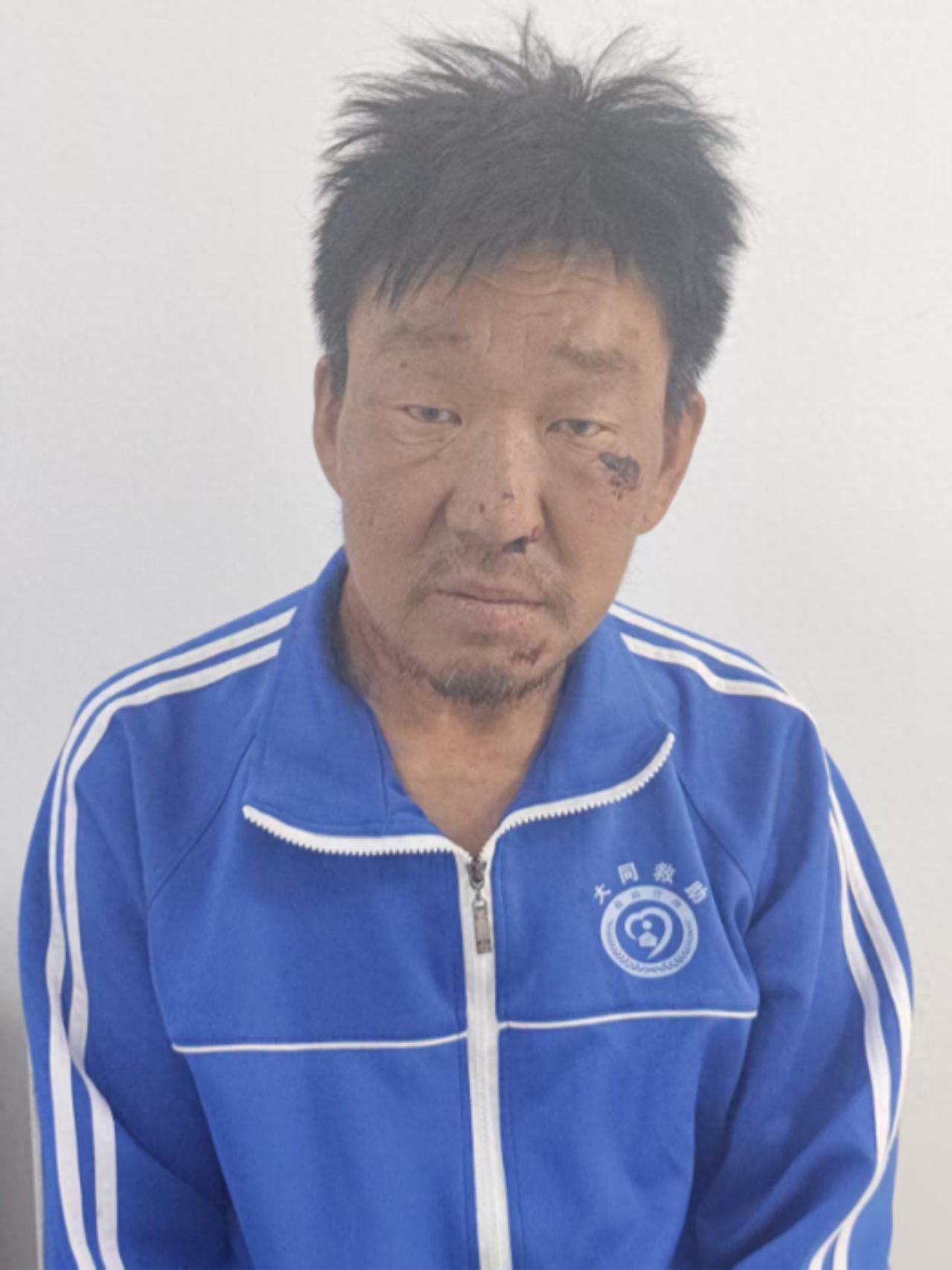 走失者照片 大同市寻亲：五旬男子被救助，自述叫...