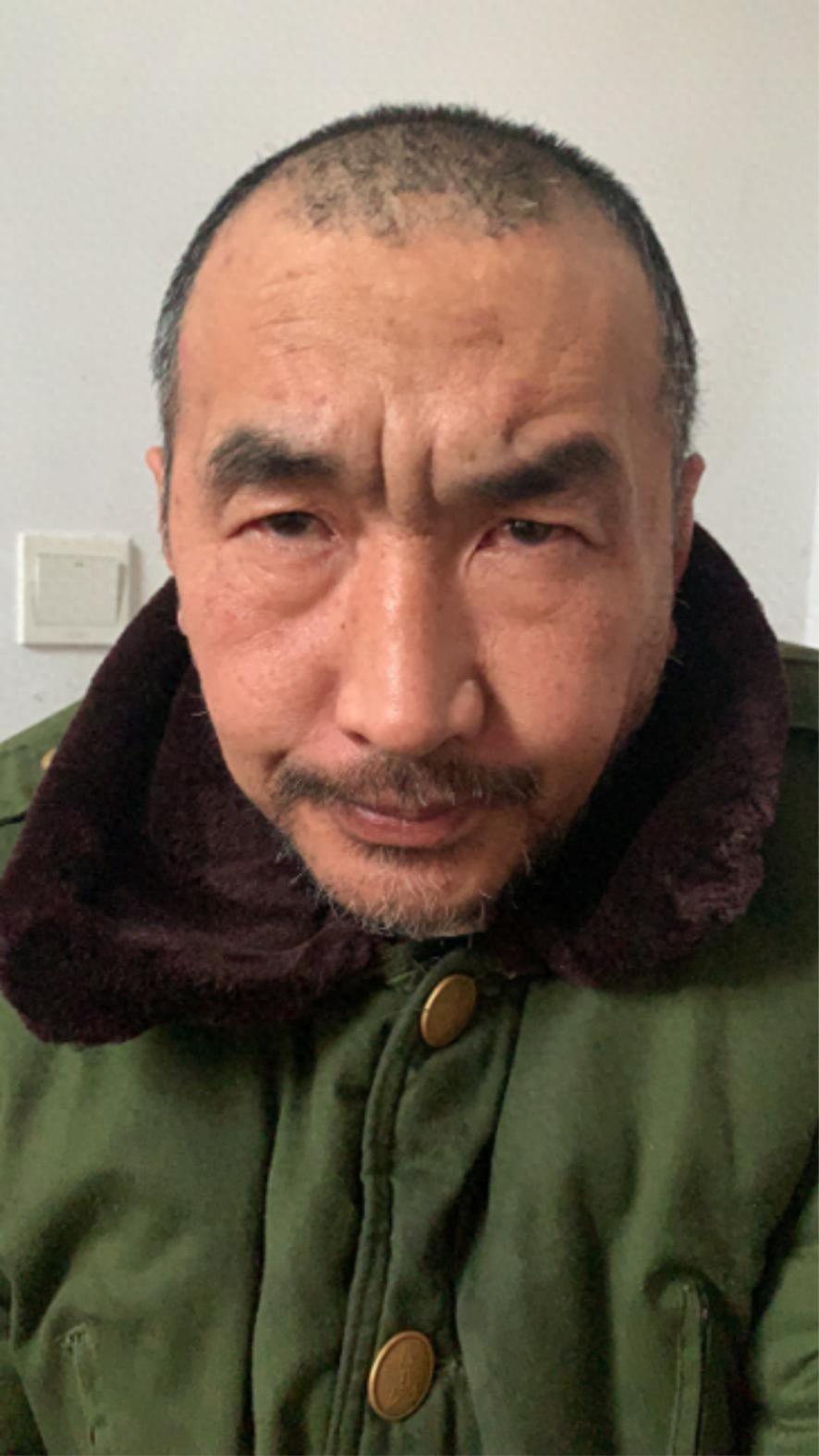 走失者照片 烟台市莱阳市寻亲：五旬男子被救助，...