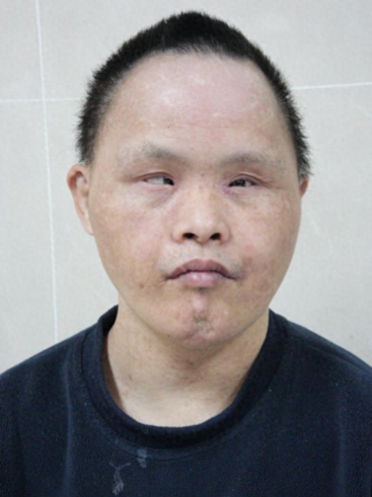走失者照片 厦门市寻亲：青年男子被救助，疑似姓...