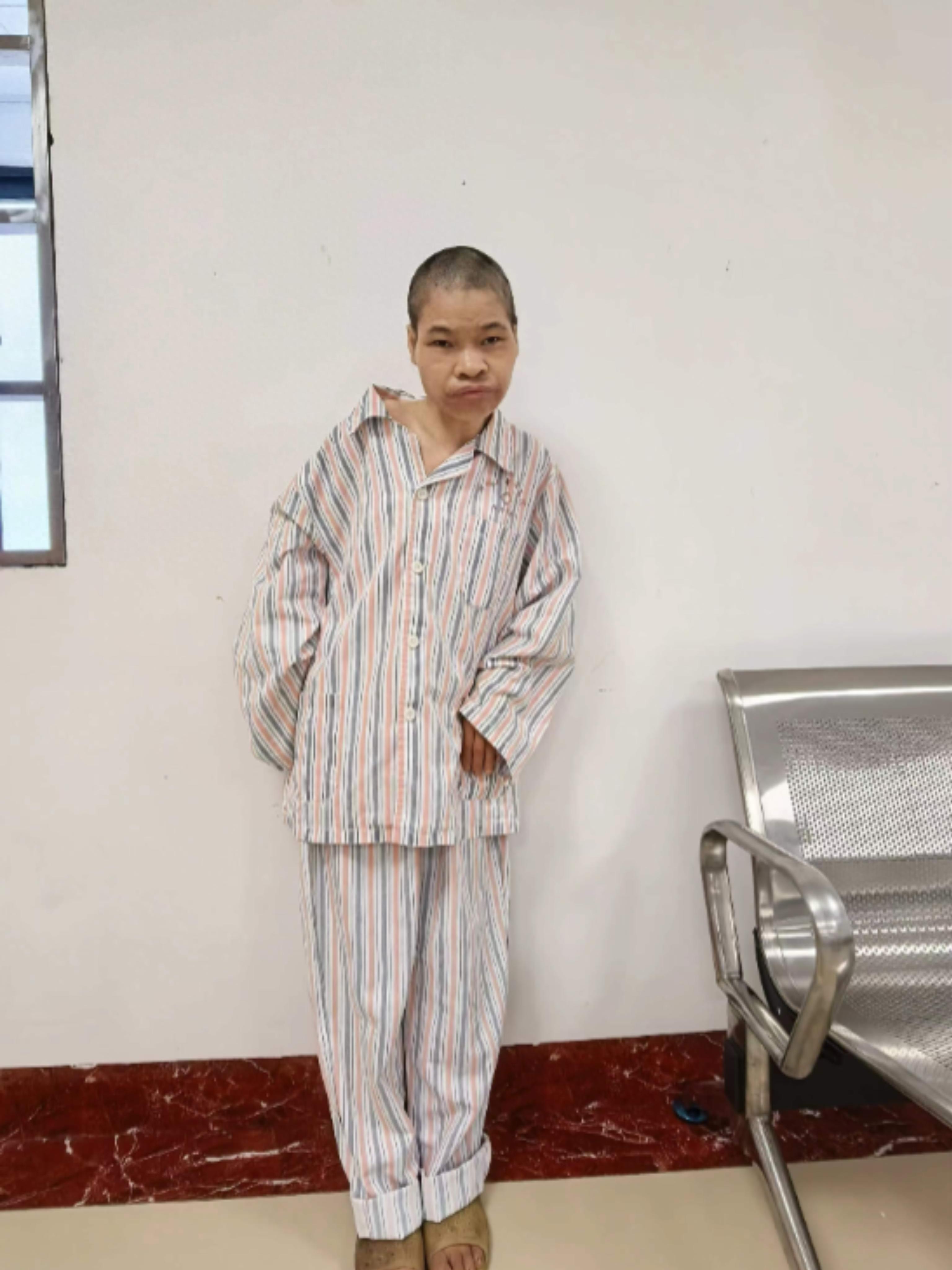 走失者照片 来宾市寻亲：中年女子被救助，疑患精...
