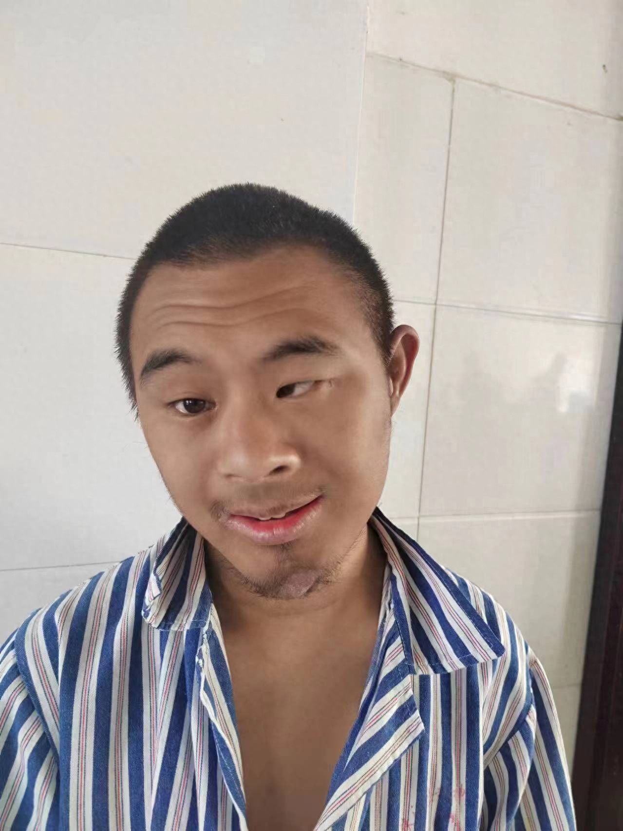 走失者照片 周口市寻亲：青年男子被救助，穿灰蓝...