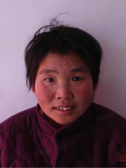 走失者照片 晋中市寻亲：中年女子被救助，无法沟...