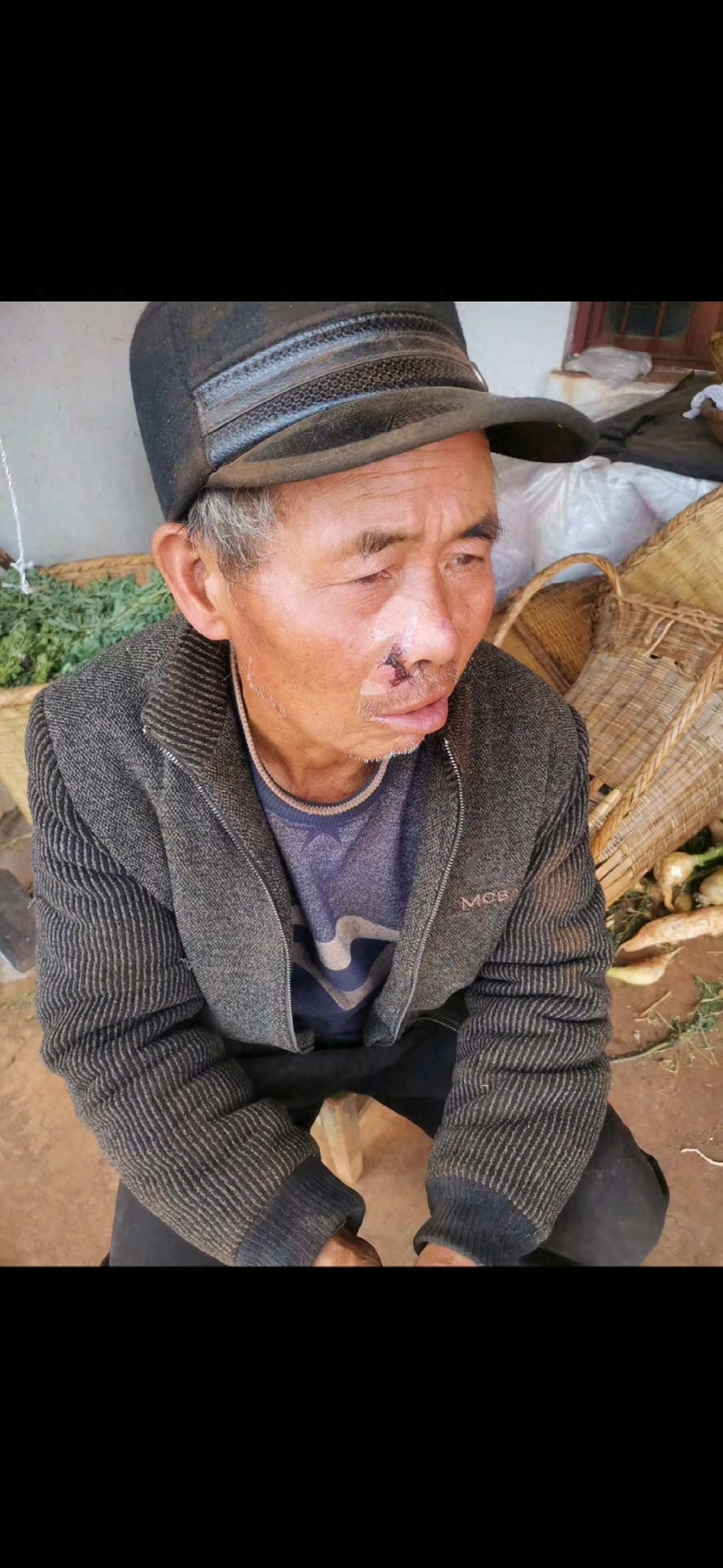走失者照片 曲靖市寻人：六旬老人走失，戴帽子，...
