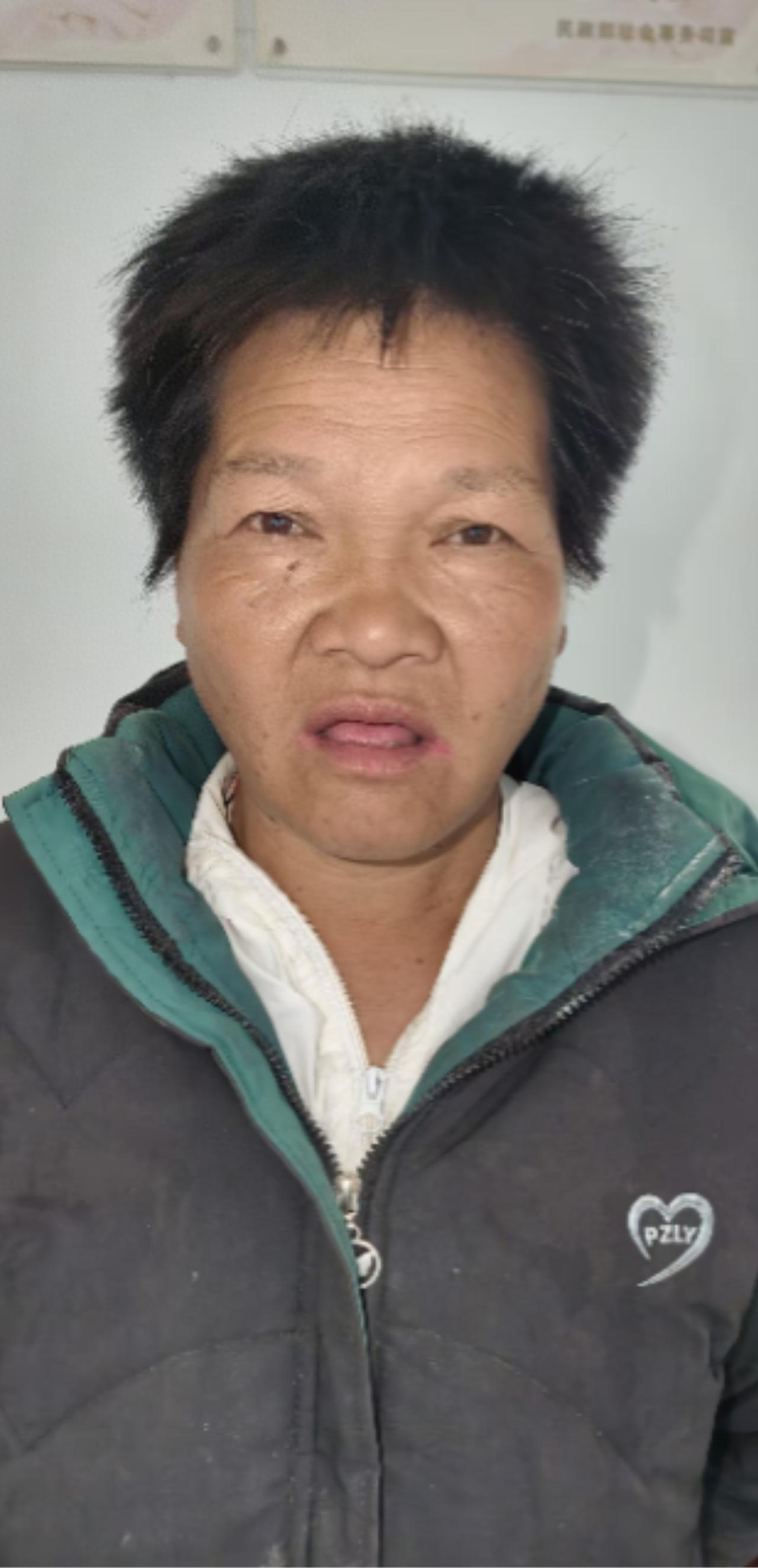 走失者照片 阜阳市寻亲：五旬女子被救助，自述叫...